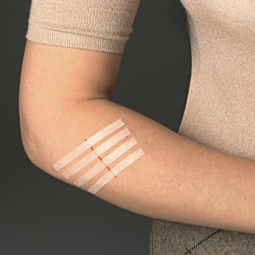 3M Steri-Strip Wundverschlussstreifen 6 x 38 mm (12 x 6 Str.) 3M Steri-Strip Wundverschlussstreifen 6 x 38 mm (12 x 6 Str.) - Bild-Darstellung des Produktes 1