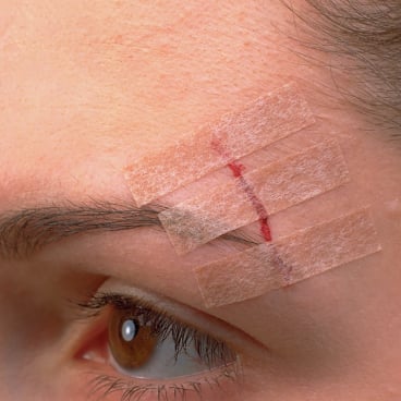 3M Steri-Strip Blendtone 6 x 75 mm, Wundverschlussstreifen (12 x 3 Str.) 3M Steri-Strip Blendtone 6 x 75 mm, Wundverschlussstreifen (12 x 3 Str.) - Bild-Darstellung des Produktes 1